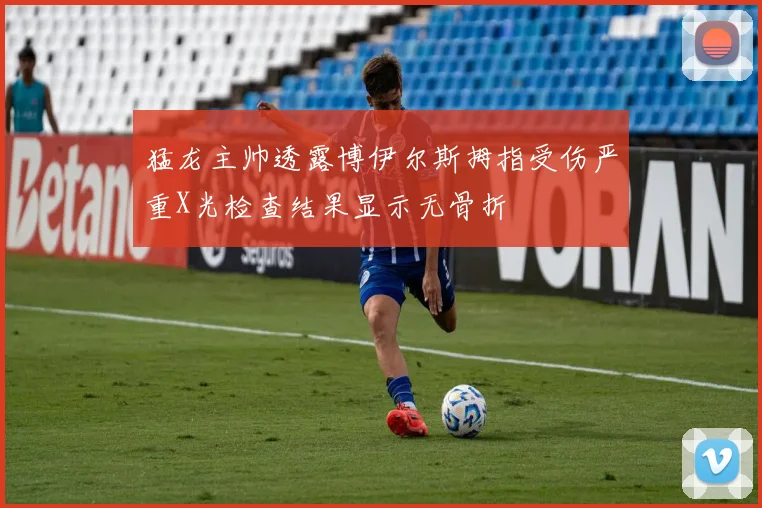 猛龙主帅透露博伊尔斯拇指受伤严重X光检查结果显示无骨折